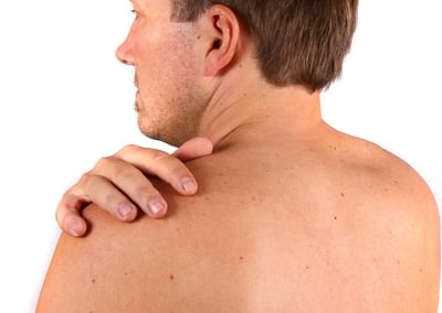 Skin cancer vs harmless spots