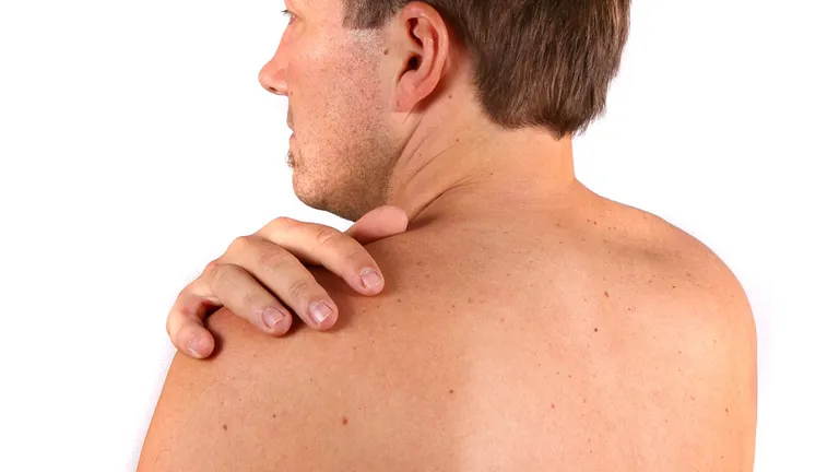 Skin cancer vs harmless spots