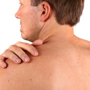 Skin cancer vs harmless spots