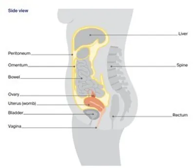 Side view diagram of female anatomy showing uterus, ovaries, bladder, rectum and labeled organs.