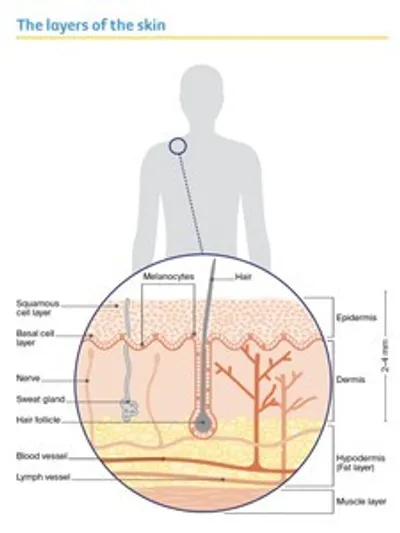 Silhouette of a person with circular skin section showing epidermis, dermis, hair follicles.