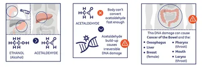 Three-panel infographic on alcohol metabolism, acetaldehyde toxicity, and cancer risks.