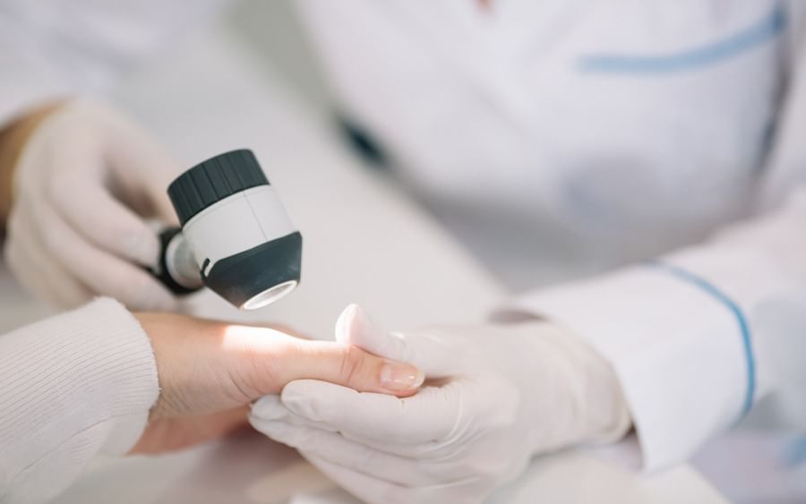 Close-up of a gloved clinician using a dermatoscope on a patient's fingertip.