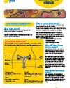 Educational poster on cancer of the uterus with diagrams of the uterus and pelvic anatomy.