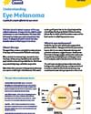 CCSA website pdf thumbnails Understanding Eye Melanoma 002