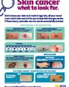 Skin cancer awareness poster titled What to Look For, showing warning signs of moles.