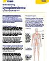 Medical poster on lymphedema with a full-body diagram and limb illustration.