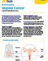 Understanding Vaginal Cancer Fact sheet