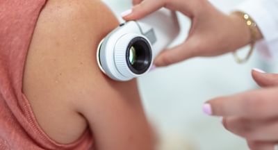 A hand holds a dermatoscope to the shoulder of a patient during a routine skin check.