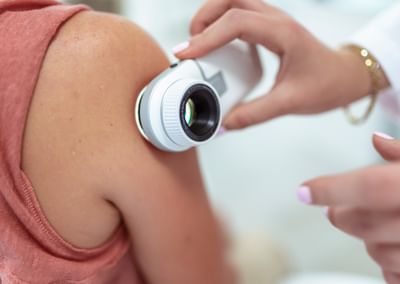 A hand holds a dermatoscope to the shoulder of a patient during a routine skin check.