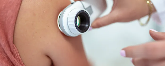 A hand holds a dermatoscope to the shoulder of a patient during a routine skin check.