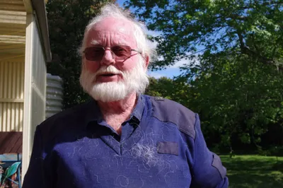 Male breast cancer survivor Robert